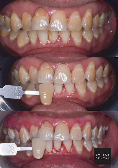 Smile Up Dental Puchong